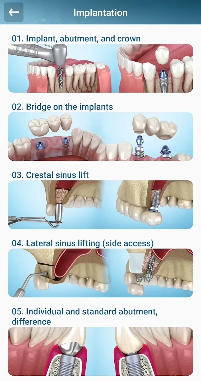Dental 3D Illustrations screenshot 4