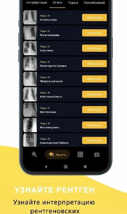Chest X-ray screenshot 2