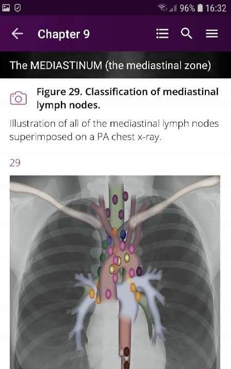 Discover Radiology: Chest X-Ray Interpretation screenshot 3