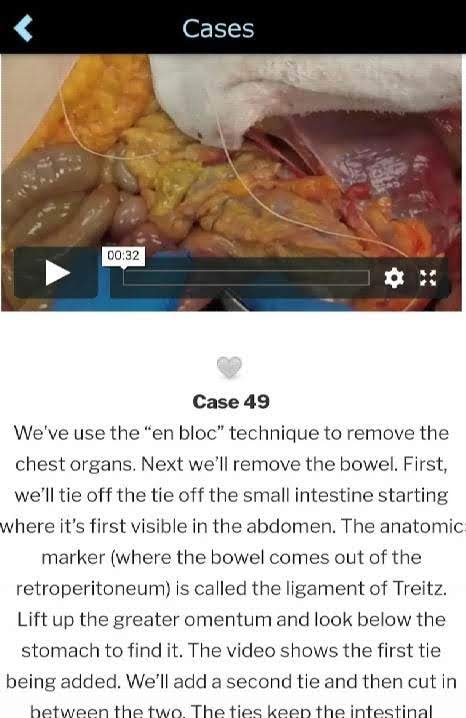 Autopsy app screenshot 4