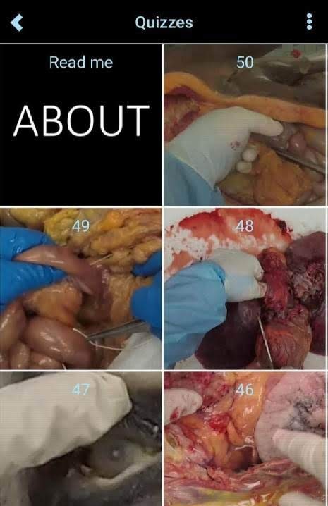 Autopsy app screenshot 2