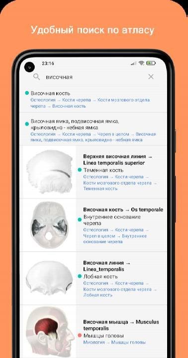 Uchi Anat Screenshot 2
